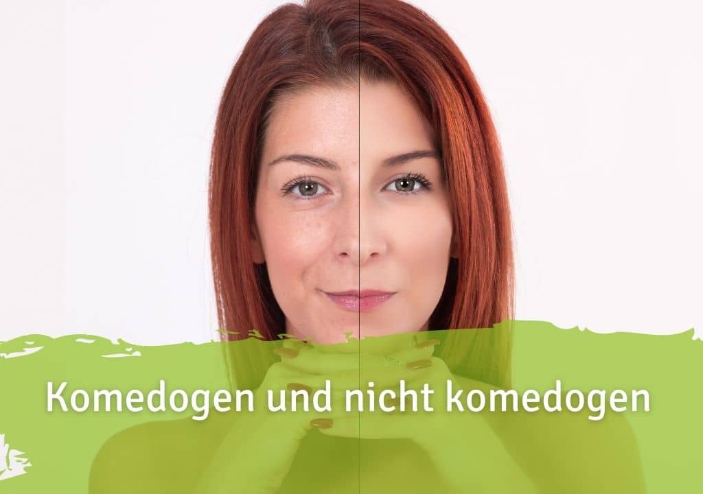 Komedogen und nicht komedogen