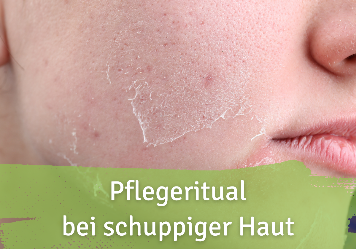 Pflegeritual bei schuppiger Haut