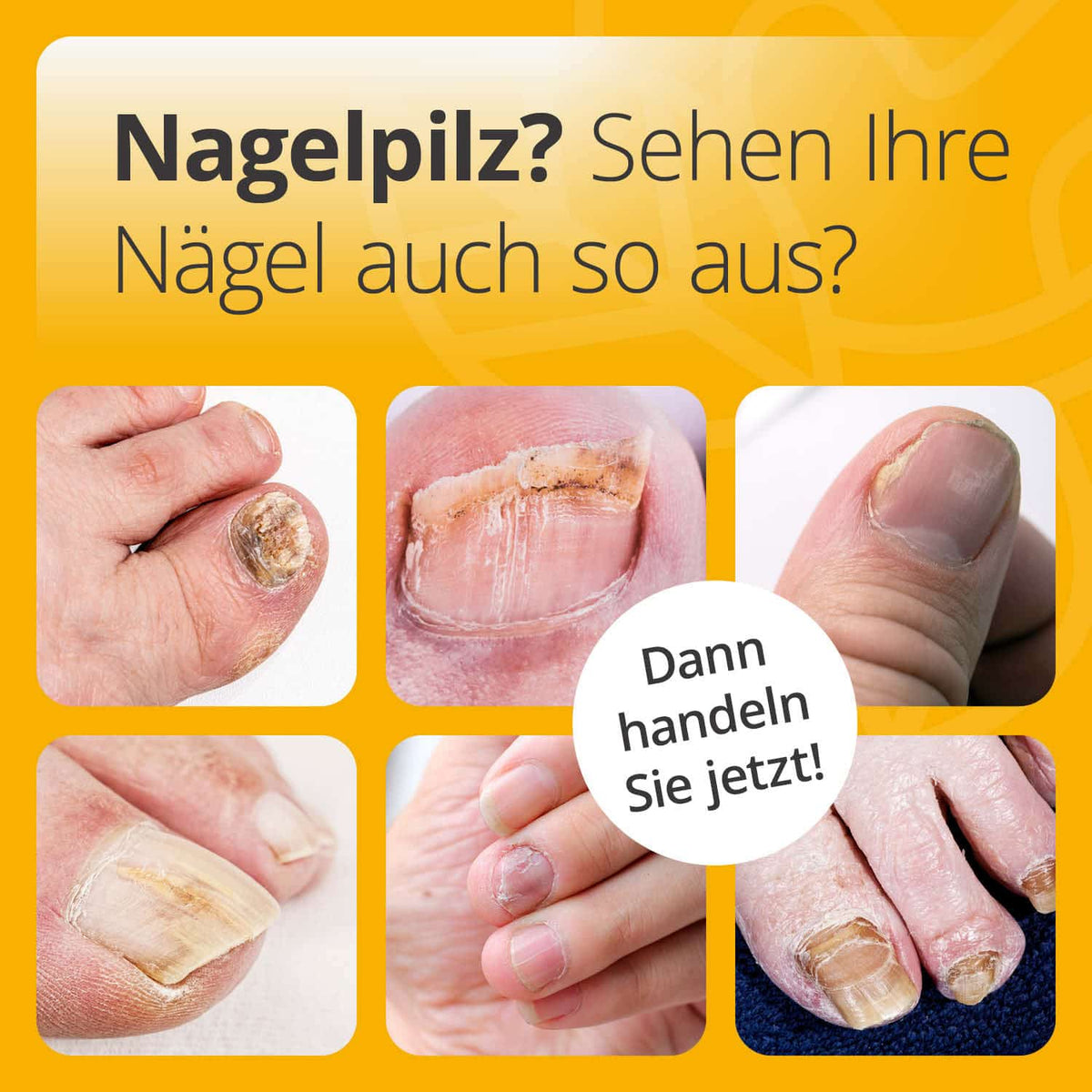 Nagelöl Repair & Protect 5+1 Aktion Nagelpilz Diagnose