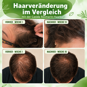 Casida Rosemary Hair Treatment specifically for Men