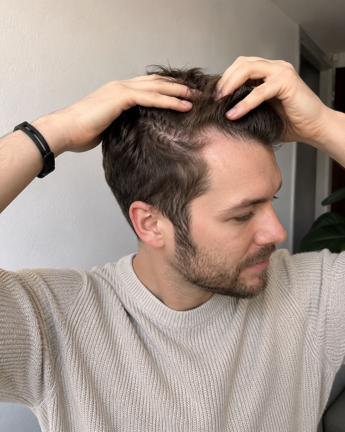 😟 Wenn dünner werdendes Haar plötzlich sichtbar wird