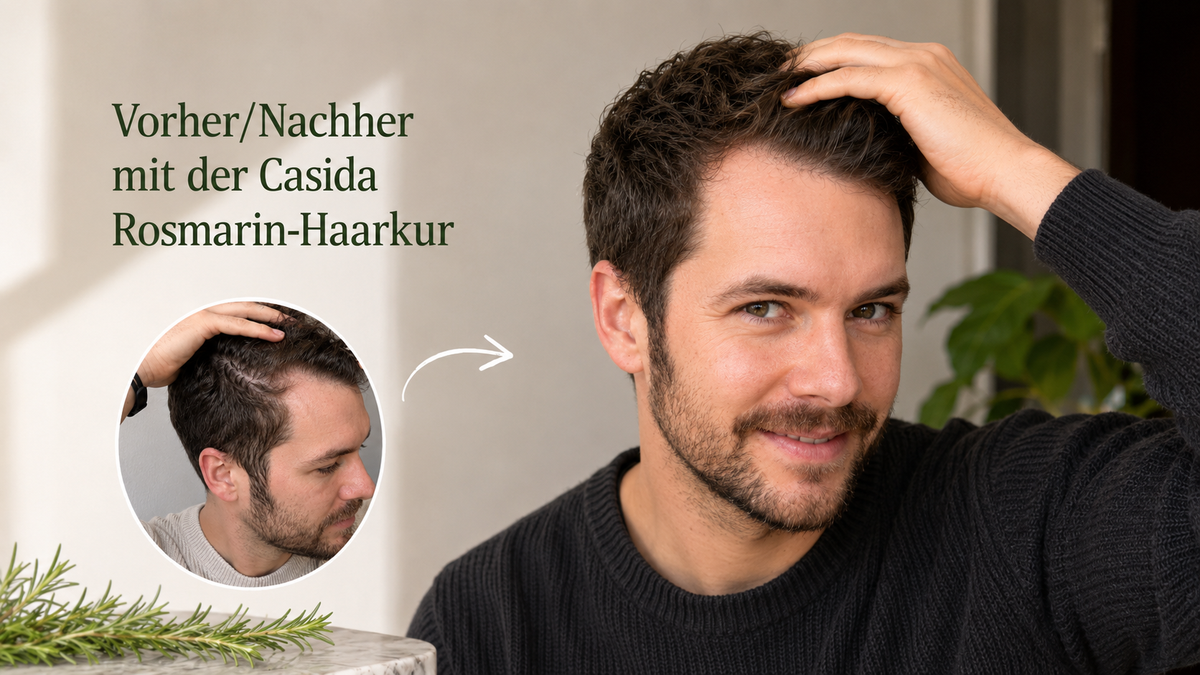 Dünner werdendes Haar, Lichtungen & Haarausfall dauerhaft stoppen (ganz ohne Chemie)