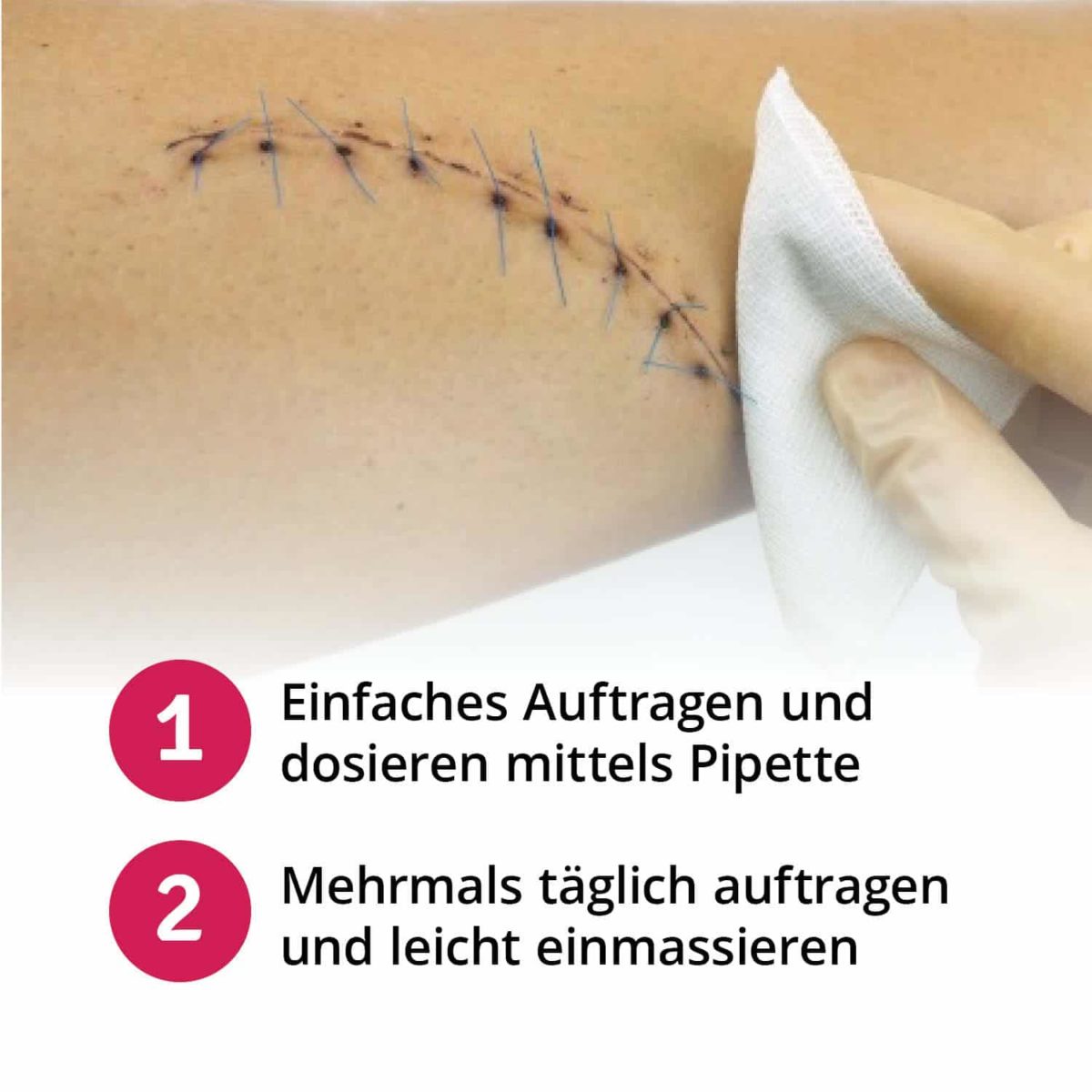 Casida Scar Care Oil Repair & Protect – 20 ml 10086758 PZN pharmacy prevent stretch marks scars naturally